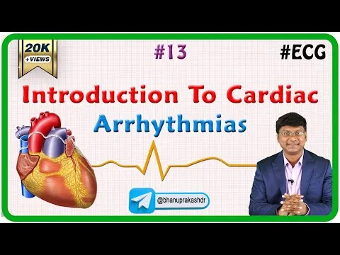 13-introduction-to-cardiac-arrhythmias-ecg-assessment-and-ecg-interpretation-made-easy-2033