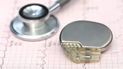 cardiac-pacemakers-part-1-3097