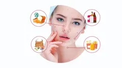 the-truth-about-acne-beauty-restoration-journey-15586